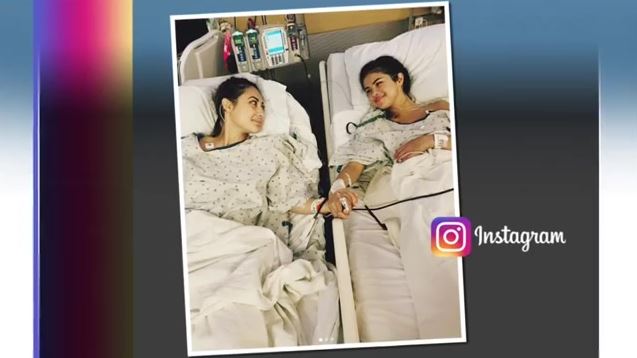 Selena Gomez undergoes kidney transplant due to lupus – WSVN 7News