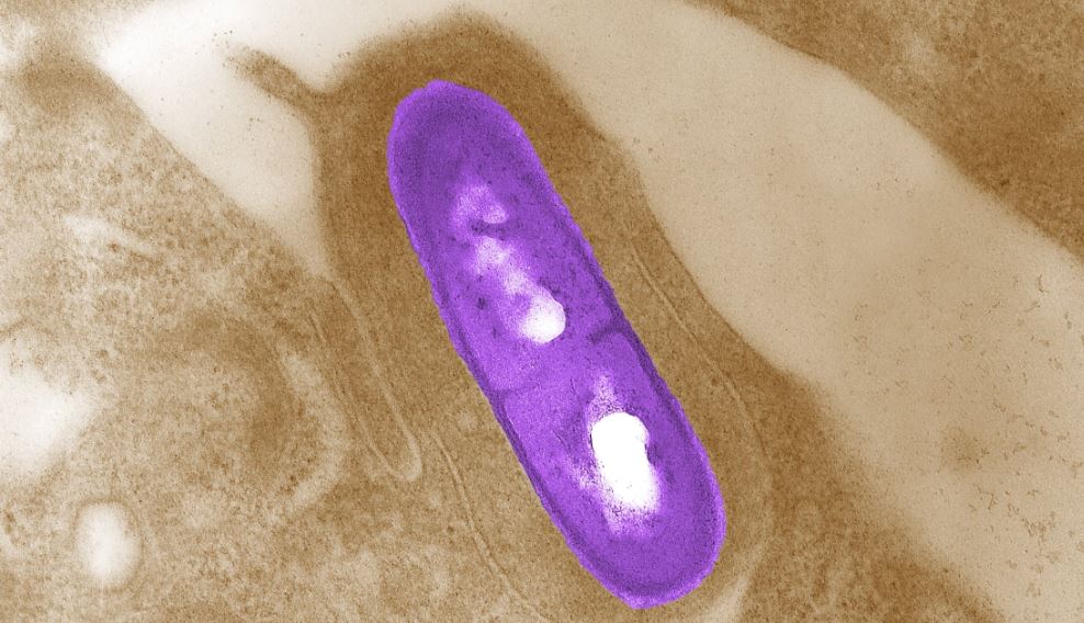 CDC warns of multistate Listeria outbreak linked to deli meats WSVN