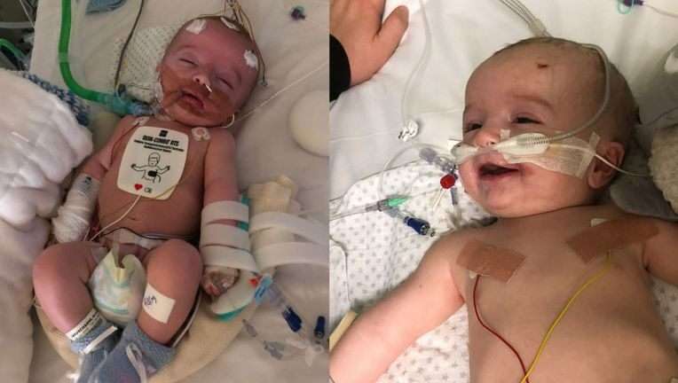 Baby Defies Odds After Waking Up From 5 Day Coma Smiles At Dad Wsvn 7news Miami News Weather Sports Fort Lauderdale