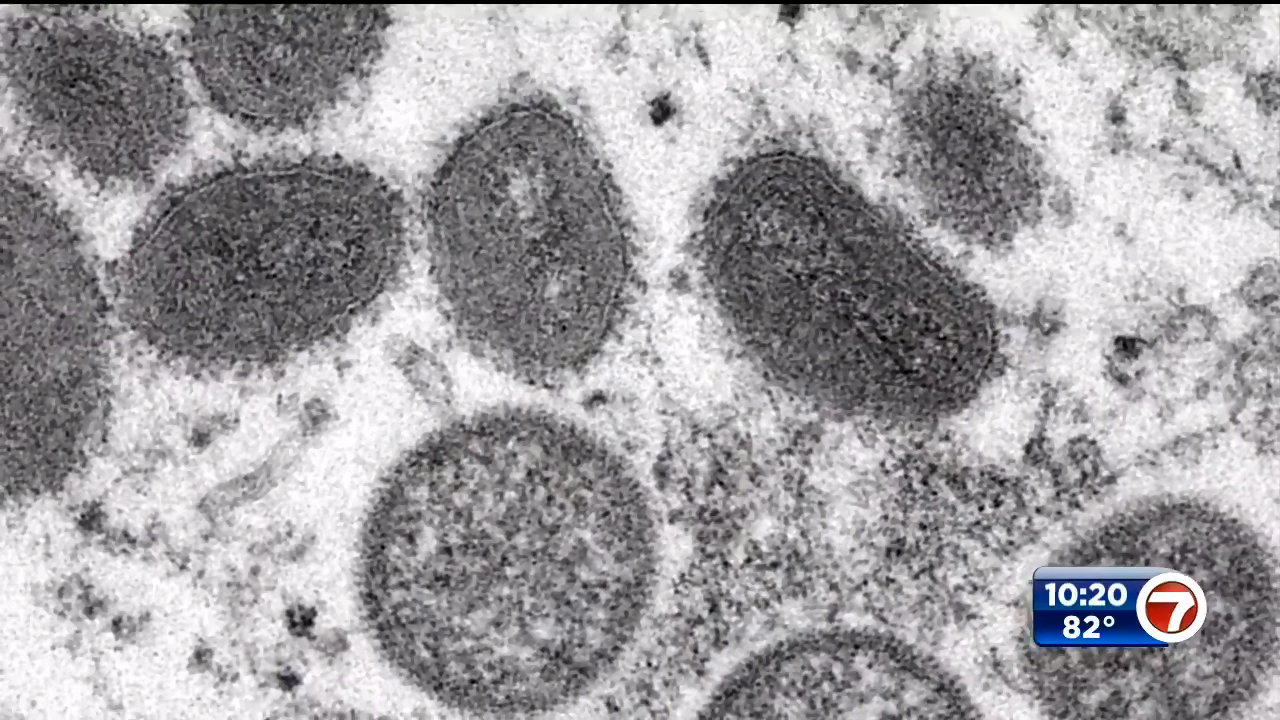 monkey pox transmission monkey pox transmission