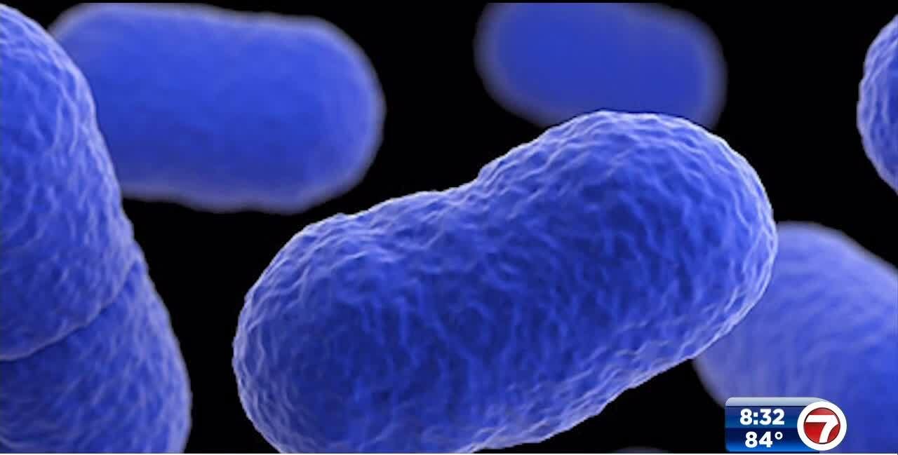 CDC New listeria outbreak tied to 23 illnesses, 1 death WSVN 7News