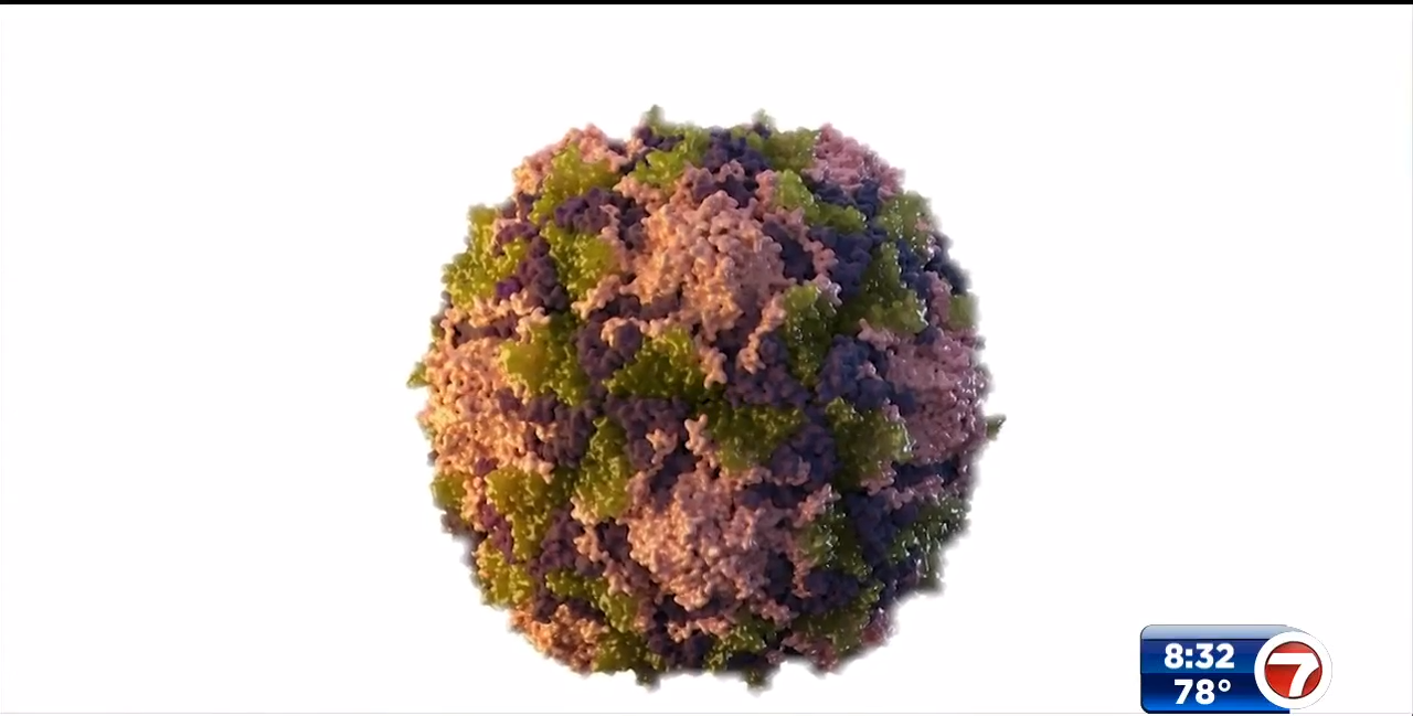 New York adult diagnosed with polio, first US case in nearly a decade WSVN 7News Miami News