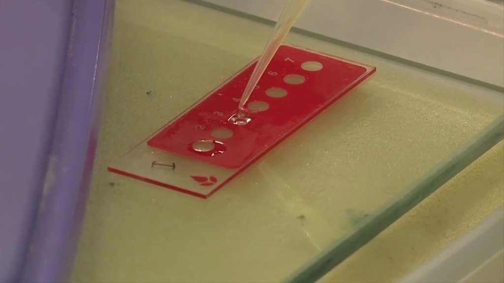 HIV vaccine candidate induces immune response in early clinical trial ...