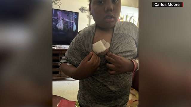Attorney for 11-year-old Mississippi boy shot by police says there's 'no way' he could have been mistaken for an adult – WSVN 7News | Miami News, Weather, Sports - Vimarsana News