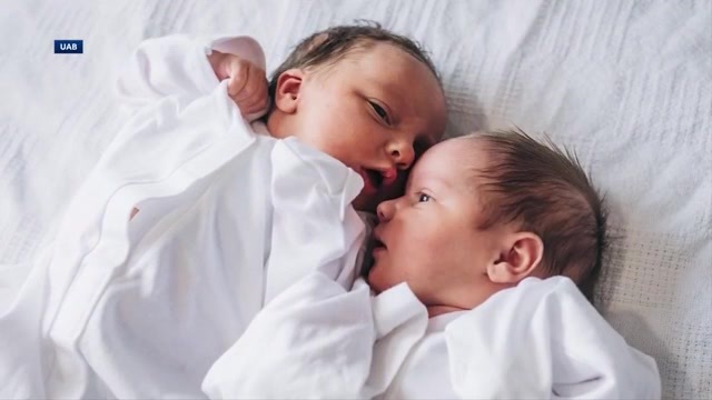 Alabama woman with rare double uterus gives birth to 2 children WSVN