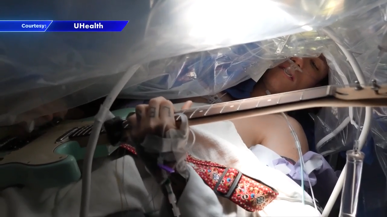 'Out of this world': Man plays guitar while undergoing brain surgery at Sylvester Comprehensive Cancer Center - WSVN 7News | Miami News, Weather, Sports - Vimarsana News