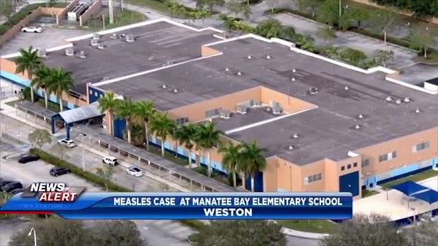 BCPS officials confirm measles case at Manatee Bay Elementary School in Weston - WSVN 7News | Miami News, Weather, Sports - Vimarsana News