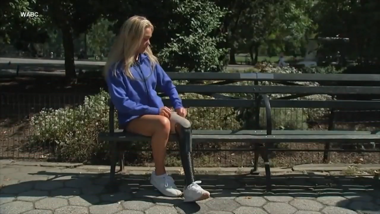 Woman prepares to run New York City Marathon 2 years after life-altering shark attack