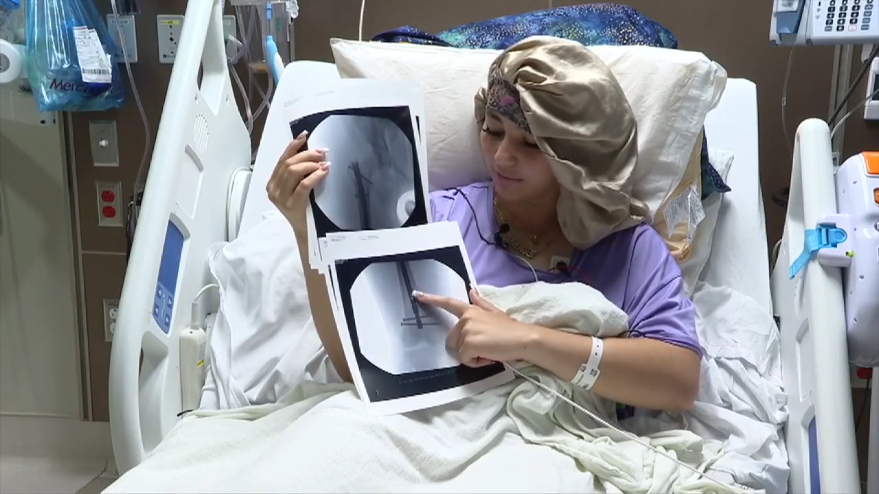 Lakeland teen suffers bone fractures after 900-pound golf cart flips, ends up atop her