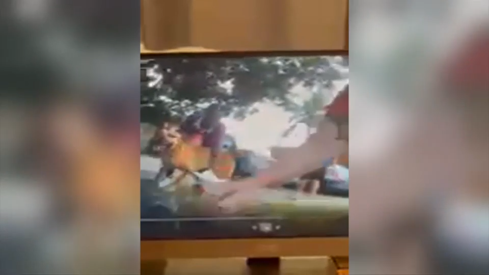 Victim of dog attack caught on video in Sunrise says he’s pressing charges against owner