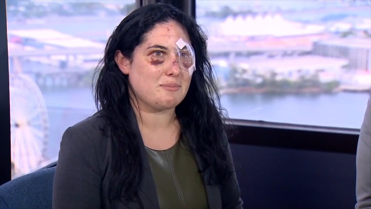 Woman describes terrifying moments after being beaten, stabbed by pen in downtown Miami