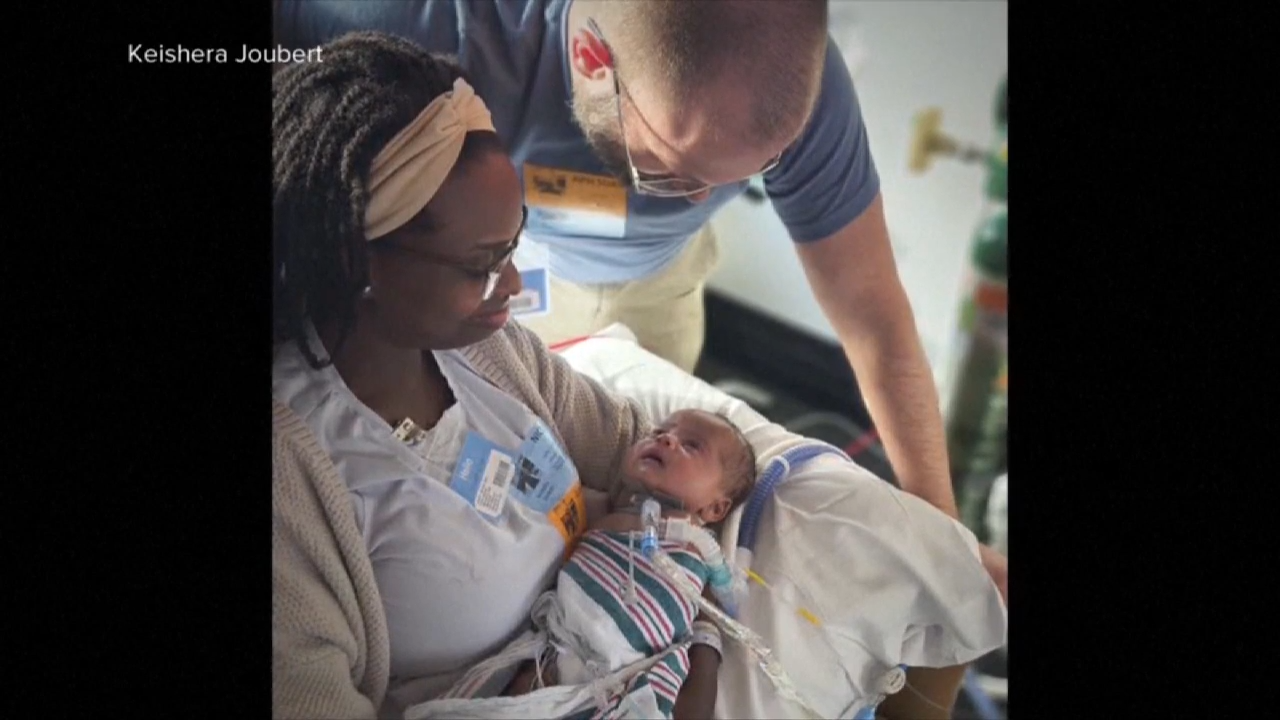 Orlando family celebrates after their baby is born twice through life-saving surgery