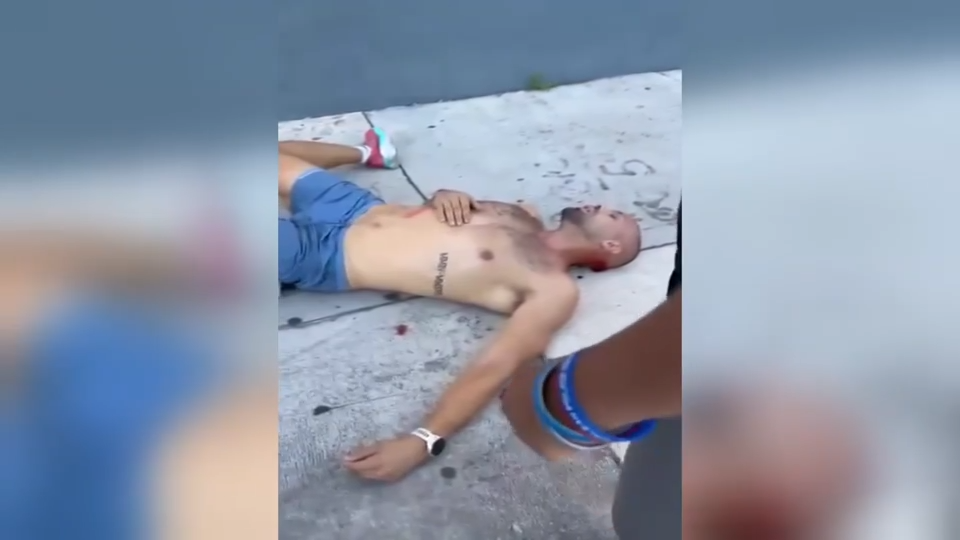 ‘I was all bit up:’ Video shows aftermath of random attack that left dog, owner with injuries in Wynwood – WSVN 7News | Miami News, Weather, Sports | Fort Lauderdale