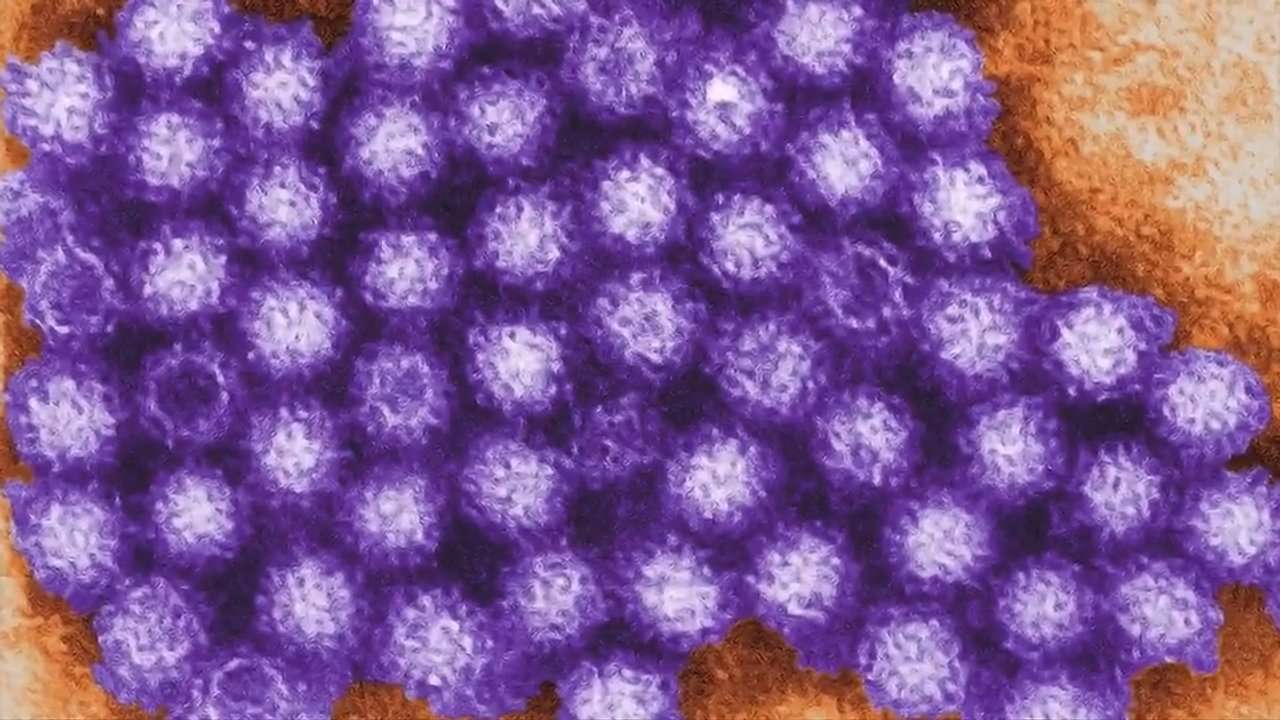 Michigan Health Officials Link Cyclospora Outbreak to Taylor Farms Lettuce Served at Taco Bell