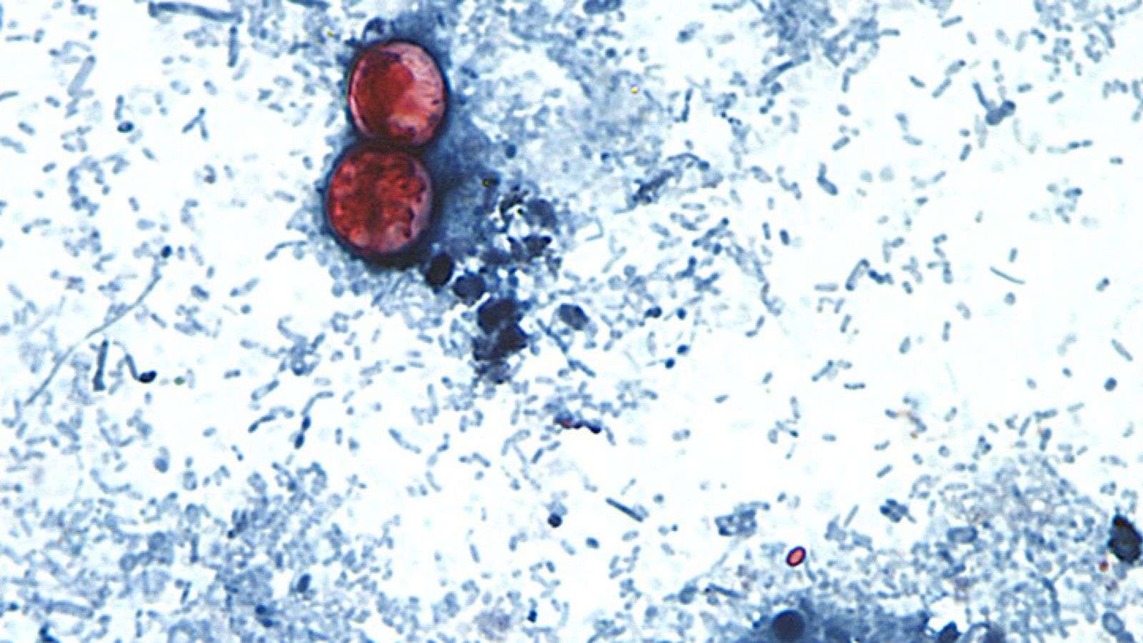 Michigan reports first 2 US deaths in outbreak of cyclospora