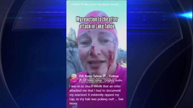 Woman attacked by otter while swimming in Lake Tahoe, receives nearly 40 stitches