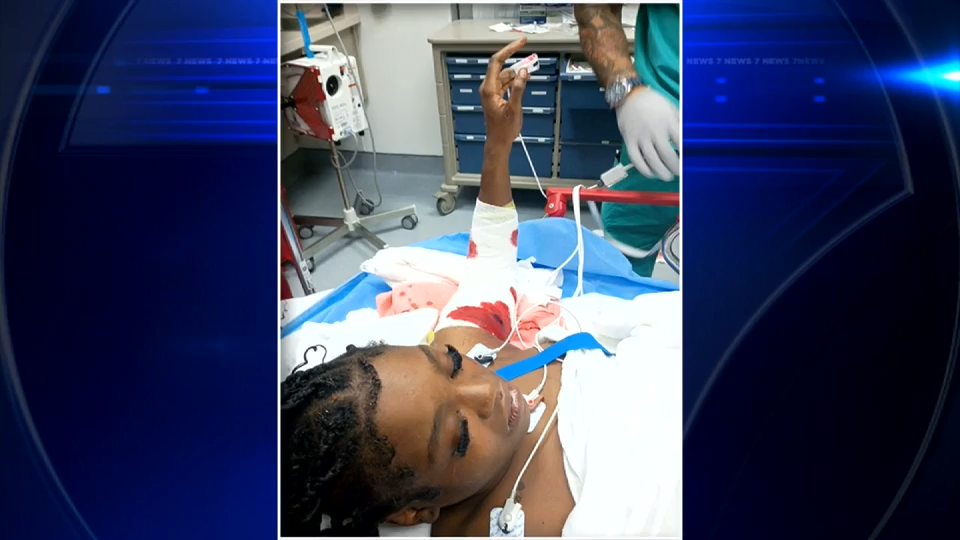 NORTHWEST MIAMI-DADE, FLA. (WSVN) - A teen is speaking out after she was seriously injured in a sudden attack by her family’s pit bull in<a class="excerpt-read-more" href="https://wsvn.com/news/local/miami-dade/makaylah-rolle-recovery-update/">Read More</a>